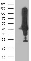 SPR antibody