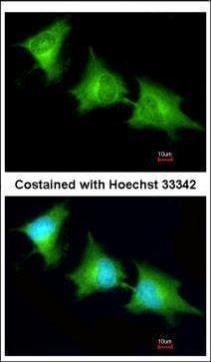 SPR antibody