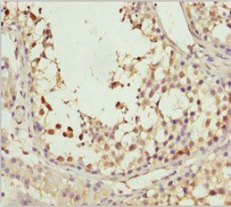 SPRED2 Antibody