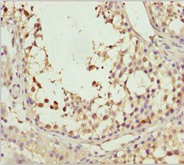 SPRED2 antibody