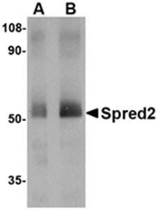 Spred2 Antibody
