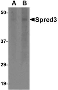 Spred3 Antibody