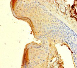 SPRR1B Antibody