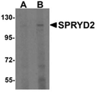 SPRYD2 Antibody