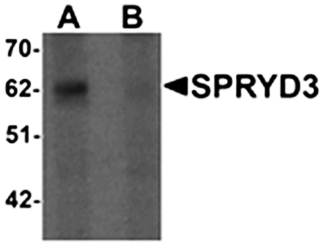 SPRYD3 Antibody