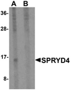 SPRYD4 Antibody