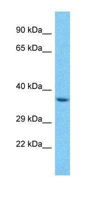 SPSB3 antibody