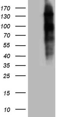SPT3 (SUPT3H) antibody