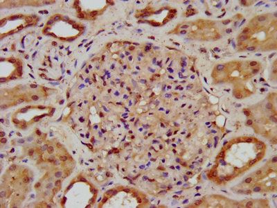 SPTBN1 Antibody