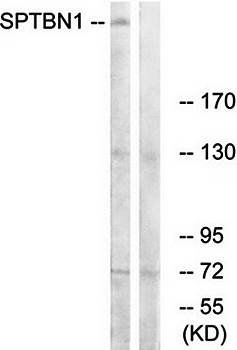 SPTBN1 antibody