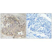 SPTBN5 Antibody