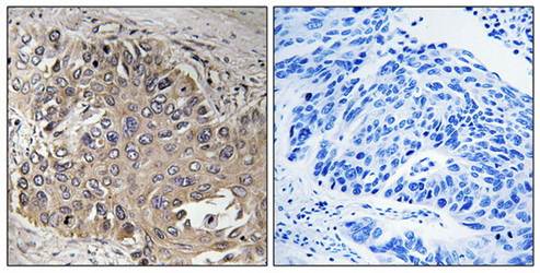 SPTBN5 Antibody