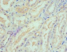 SPTLC1 Antibody