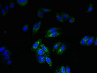 SPTLC3 Antibody