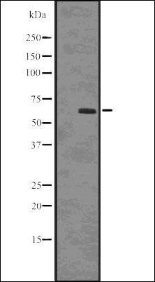SQSTM1/p62 (Phospho-Ser403) antibody