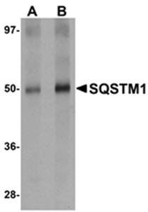 SQSTM1 Antibody