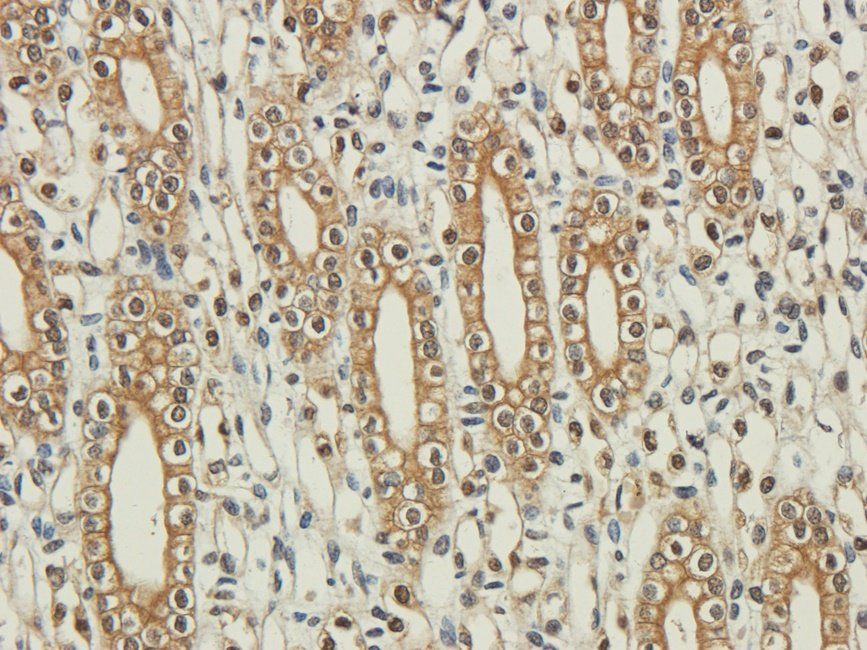 SRBP2 antibody