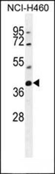 SRD5A2L2 antibody