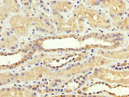 SREBF1 Antibody