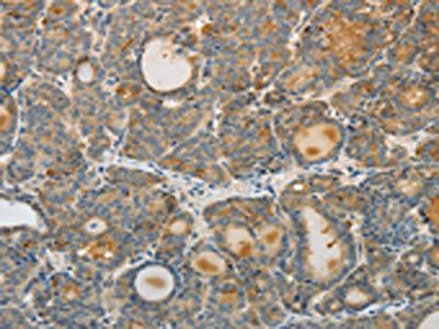 SREBF2 Antibody