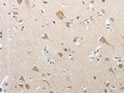 SREBF2 Antibody