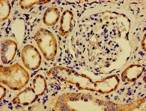 SREBF2 Antibody