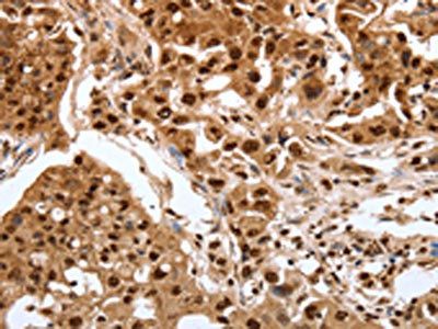 SRF Antibody