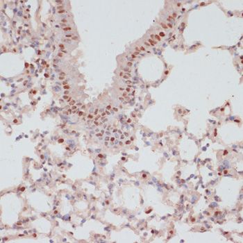 SRF (Phospho-S103) antibody