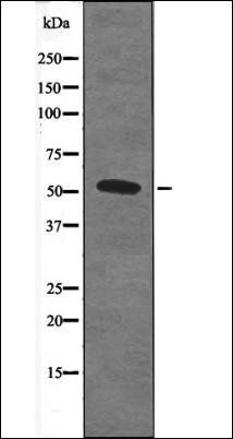 SRF (Phospho-Thr159) antibody