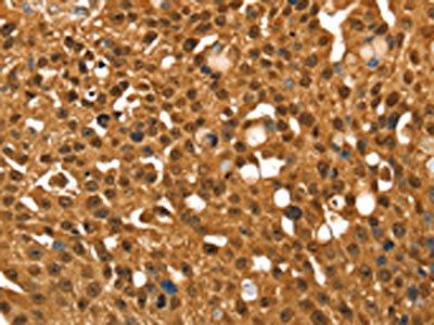 SRGAP1 Antibody