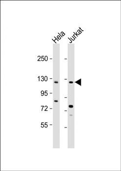 SRGAP3 antibody