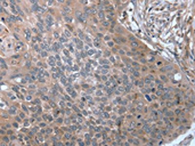 SRGAP3 Antibody