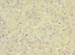 SRI Antibody