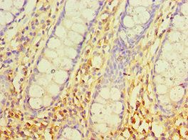 SRM Antibody