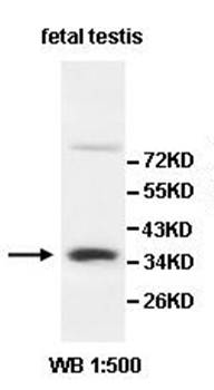 AKR1E2 Rabbit Polyclonal Antibody