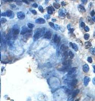 HMBS Rabbit Polyclonal Antibody