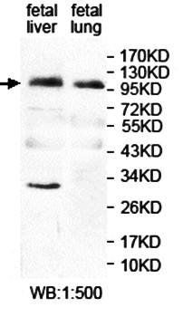 ANKRD44 antibody