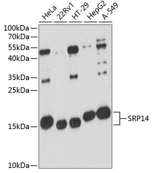 SRP14 antibody
