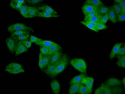 SRP14 Antibody