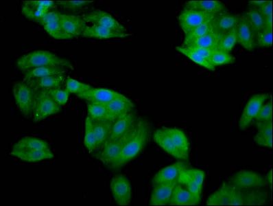 SRP14 antibody