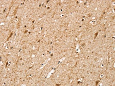 SRP68 Antibody