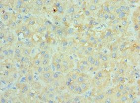 SRPK1 Antibody