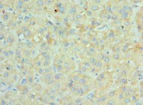 SRPK1 antibody