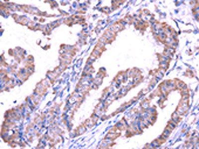 SRPK1 Antibody