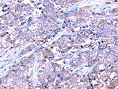 SRPK1 Antibody