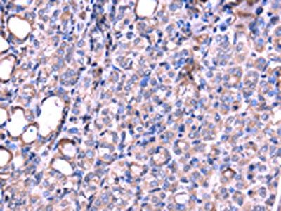 SRPK3 Antibody