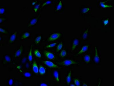 SRPRB Antibody