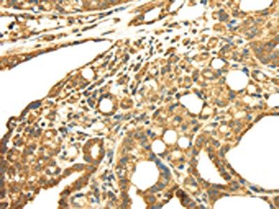 SRPRB Antibody