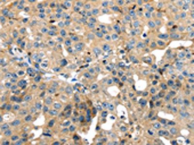 SRPX Antibody