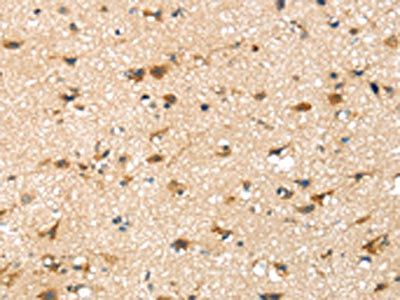 SRPX Antibody